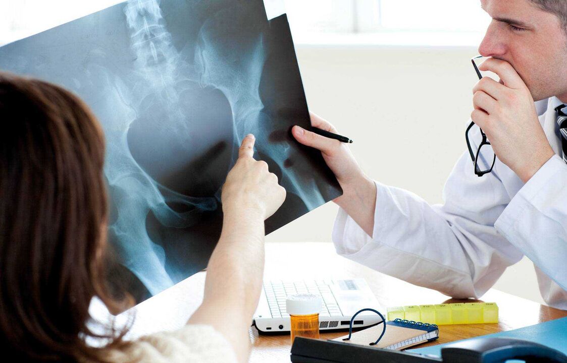 doctors examining x-ray for hip arthropathy