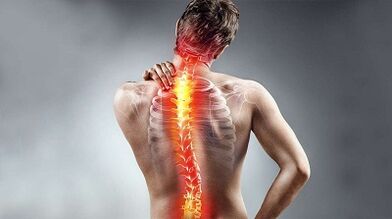Symptoms of back pain